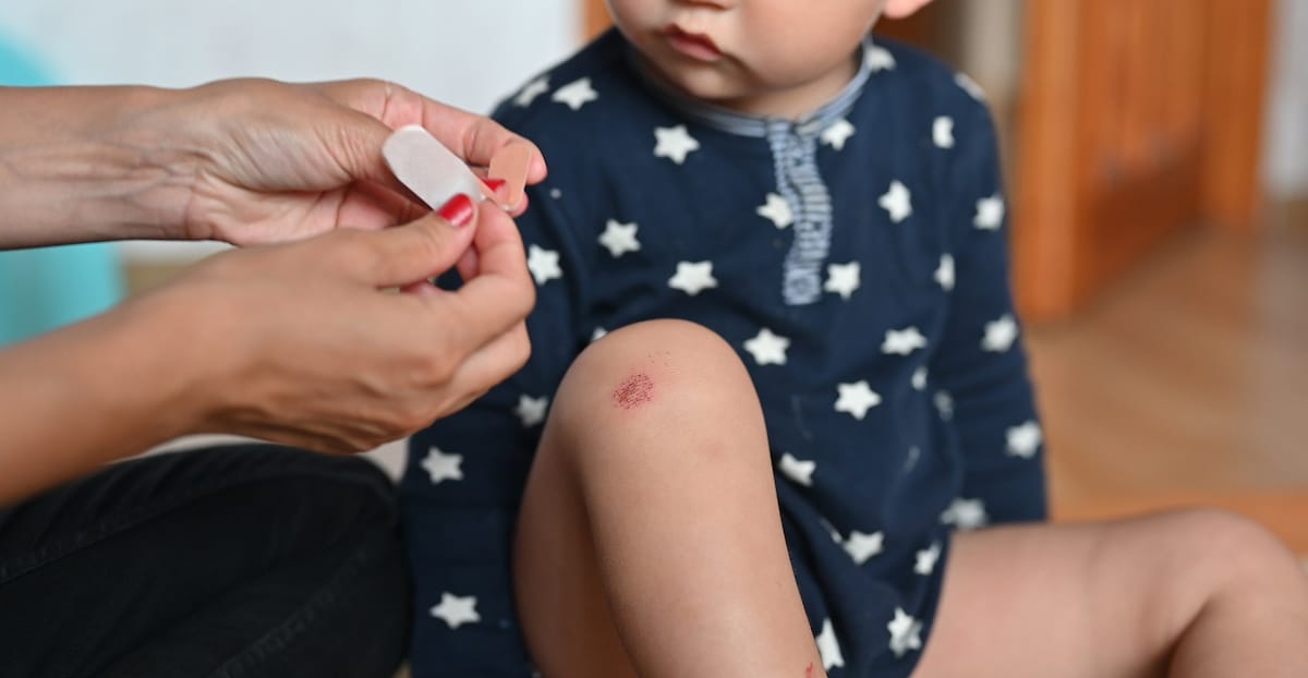 mother-heals-wound-child-s-leg